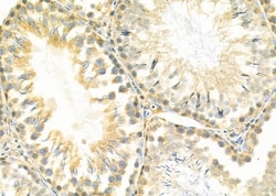Invitrogen ELAVL2 Polyclonal Antibody 100 &mu;L; Unconjugated:Antibodies,