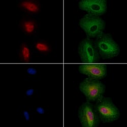 Invitrogen FOXC1/FOXC2 Polyclonal Antibody 100 &mu;L; Unconjugated:Antibodies,