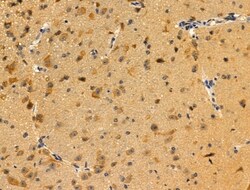 Invitrogen FOXC1/FOXC2 Polyclonal Antibody 100 &mu;L; Unconjugated:Antibodies,