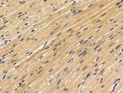 Invitrogen FOXC1/FOXC2 Polyclonal Antibody 100 &mu;L; Unconjugated:Antibodies,