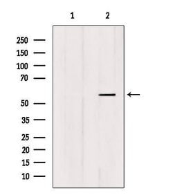 Invitrogen FOXC1/FOXC2 Polyclonal Antibody 100 &mu;L; Unconjugated:Antibodies,