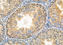 Invitrogen CAF1 p60 Polyclonal Antibody 100 &mu;L; Unconjugated:Antibodies,