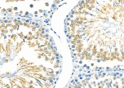 Invitrogen CAF1 p60 Polyclonal Antibody 100 &mu;L; Unconjugated:Antibodies,