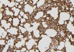 Invitrogen JIP2 Polyclonal Antibody 100 &mu;L; Unconjugated:Antibodies,