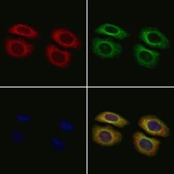 Invitrogen TOP3A Polyclonal Antibody 100 &mu;L; Unconjugated:Antibodies,