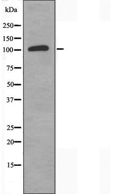 Invitrogen TOP3A Polyclonal Antibody 100 &mu;L; Unconjugated:Antibodies,