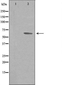 Invitrogen GTF2H2 Polyclonal Antibody 100 &mu;L; Unconjugated:Antibodies,