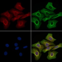 Invitrogen MELK Polyclonal Antibody 100 &mu;L; Unconjugated:Antibodies,