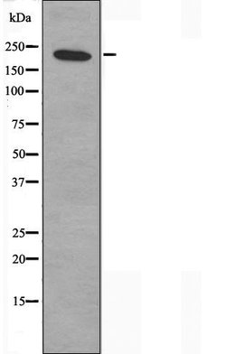 Invitrogen ZNF638 Polyclonal Antibody 100 &mu;L; Unconjugated:Antibodies,