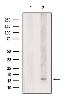 Invitrogen p35 Polyclonal Antibody 100 &mu;L | Buy Online | Invitrogen&trade; | Fisher Scientific