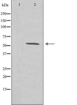 Invitrogen ZNF187 Polyclonal Antibody 100 &mu;L; Unconjugated:Antibodies,