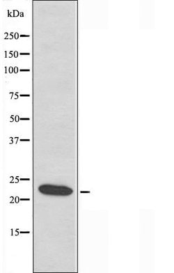 Invitrogen LDOC1L Polyclonal Antibody 100 &mu;L | Buy Online | Invitrogen&trade; | Fisher Scientific
