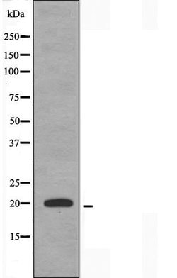 Invitrogen TNFAIP8L2 Polyclonal Antibody 100 &mu;L; Unconjugated:Antibodies,