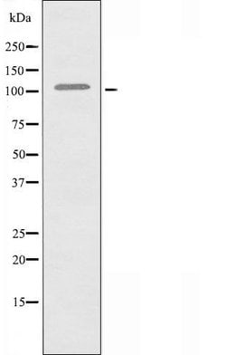 Invitrogen KSR2 Polyclonal Antibody 100 &mu;L | Buy Online | Invitrogen&trade; | Fisher Scientific