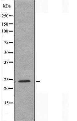 Invitrogen MOB4A Polyclonal Antibody 100 &mu;L | Buy Online | Invitrogen&trade; | Fisher Scientific