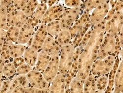 Invitrogen MAP4K3 Polyclonal Antibody 100 &mu;L; Unconjugated:Antibodies,