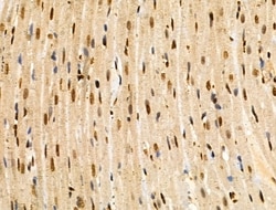 Invitrogen MAP4K3 Polyclonal Antibody 100 &mu;L; Unconjugated:Antibodies,
