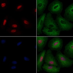 Invitrogen DBC1 Polyclonal Antibody 100 &mu;L | Buy Online | Invitrogen&trade; | Fisher Scientific