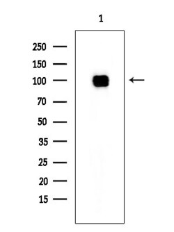 Invitrogen DBC1 Polyclonal Antibody 100 &mu;L | Buy Online | Invitrogen&trade; | Fisher Scientific