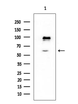 Invitrogen DBC1 Polyclonal Antibody 100 &mu;L | Buy Online | Invitrogen&trade; | Fisher Scientific