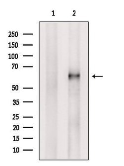 Invitrogen ACRBP Polyclonal Antibody 100 &mu;L; Unconjugated:Antibodies,