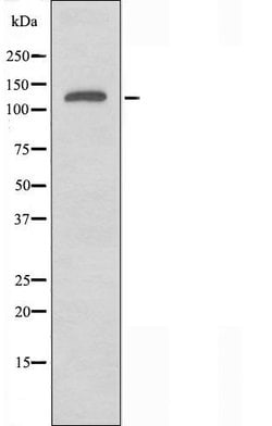 Invitrogen RGAG1 Polyclonal Antibody 100 &mu;L | Buy Online | Invitrogen&trade; | Fisher Scientific