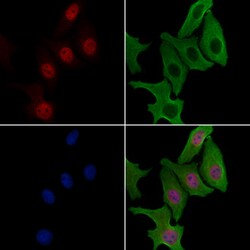 ZNF397 Polyclonal Antibody:Antibodies, Polyclonal