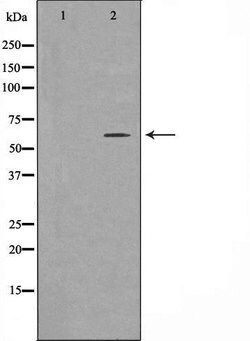 ZNF397 Polyclonal Antibody:Antibodies, Polyclonal