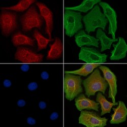 Invitrogen ANKK1 Polyclonal Antibody 100 &mu;L; Unconjugated:Antibodies,