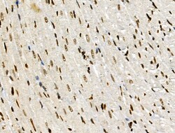 Invitrogen PPP1R14C Polyclonal Antibody 100 &mu;L; Unconjugated:Antibodies,