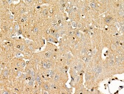 Invitrogen PPP1R14C Polyclonal Antibody 100 &mu;L; Unconjugated:Antibodies,