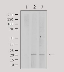 Invitrogen PPP1R14C Polyclonal Antibody 100 &mu;L; Unconjugated:Antibodies,