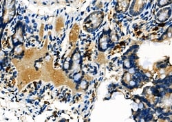 Invitrogen RIN3 Polyclonal Antibody 100 &mu;L; Unconjugated:Antibodies,