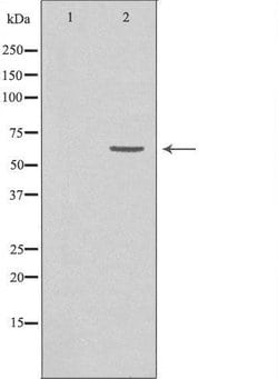 Invitrogen GRK7 Polyclonal Antibody 100 &mu;L; Unconjugated:Antibodies,