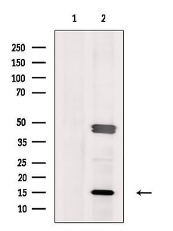 Invitrogen ORAOV1 Polyclonal Antibody 100 &mu;L; Unconjugated:Antibodies,