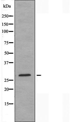 Invitrogen BRI3BP Polyclonal Antibody 100 &mu;L; Unconjugated:Antibodies,