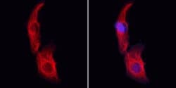 Invitrogen SMG7 Polyclonal Antibody 100 &mu;L; Unconjugated:Antibodies,
