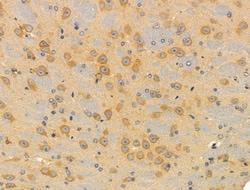 Invitrogen SMG7 Polyclonal Antibody 100 &mu;L; Unconjugated:Antibodies,