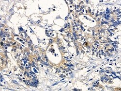 Invitrogen CNKSR1 Polyclonal Antibody 100 &mu;L; Unconjugated:Antibodies,