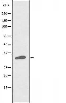Invitrogen RASD2 Polyclonal Antibody 100 &mu;L; Unconjugated:Antibodies,