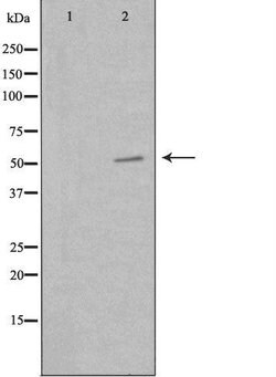 Invitrogen PKNOX2 Polyclonal Antibody 100 &mu;L | Buy Online | Invitrogen&trade; | Fisher Scientific
