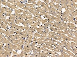 Invitrogen LMTK3 Polyclonal Antibody 100 &mu;L | Buy Online | Invitrogen&trade; | Fisher Scientific