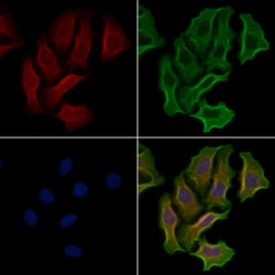 Invitrogen RPS6KC1 Polyclonal Antibody 100 &mu;L; Unconjugated:Antibodies,