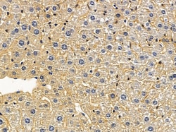Invitrogen RPS6KC1 Polyclonal Antibody 100 &mu;L; Unconjugated:Antibodies,