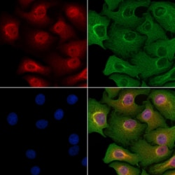 Invitrogen FOXB1/FOXB2 Polyclonal Antibody 100 &mu;L; Unconjugated:Antibodies,