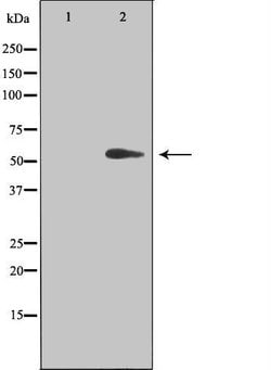 Invitrogen TIN2 Polyclonal Antibody 100 &mu;L; Unconjugated:Antibodies,