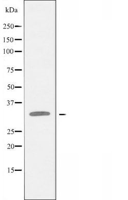 Invitrogen C1orf35 Polyclonal Antibody 100 &mu;L; Unconjugated:Antibodies,