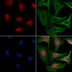 Invitrogen NY-BR-1 Polyclonal Antibody 100 &mu;L; Unconjugated:Antibodies,