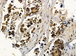 Invitrogen NY-BR-1 Polyclonal Antibody 100 &mu;L; Unconjugated:Antibodies,