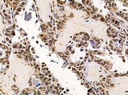 Invitrogen NY-BR-1 Polyclonal Antibody 100 &mu;L; Unconjugated:Antibodies,